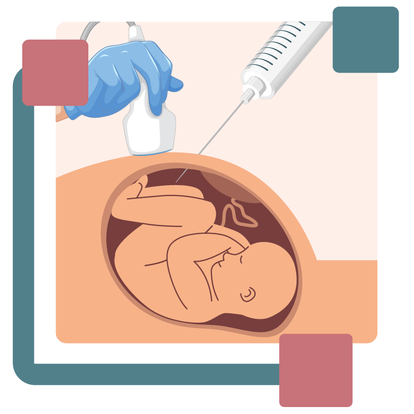 Amniocentesis test