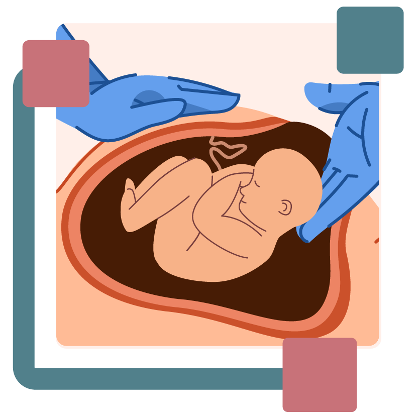 C_section